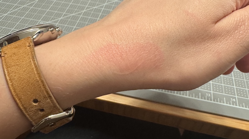 photo close up on my wrist were there's a light red mark where i burned myself